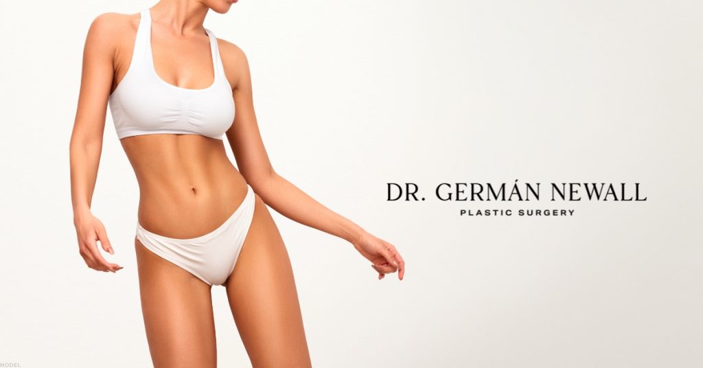 Woman showing body contouring results after CoolSculpting® treatment (model)