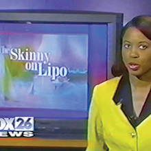 FOX 26 News conducts a segment on Dr. Newall and his liposuction technique