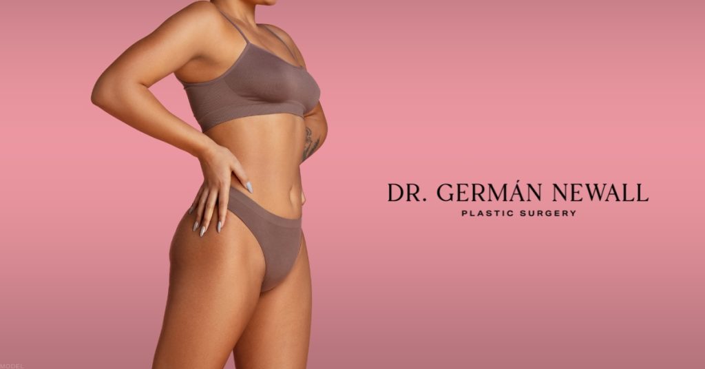 Woman representing body contour after liposuction (model)