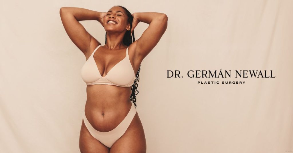 Woman after tummy tuck surgery. (Model)