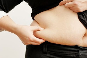 Liposuction Candidacy in Houston, TX
